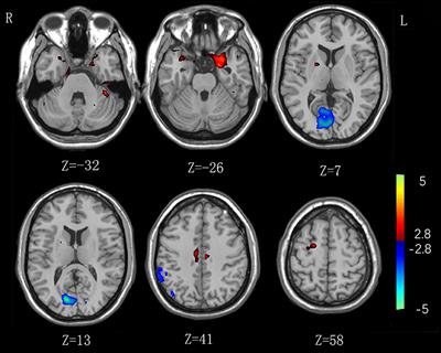 Abnormal Functional Connectivity in Cognitive Control Network, Default Mode Network, and Visual Attention Network in Internet Addiction: A Resting-State fMRI Study